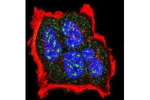 Immunofluorescence (IF) image for anti-Tuberous Sclerosis 2 (TSC2) (pSer1420) antibody (ABIN3001840)