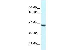 WB Suggested Anti-Wdr45l Antibody   Titration: 1. (WD Repeat Domain 45B (WDR45B) (N-Term) Antikörper)