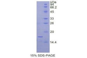 SDS-PAGE (SDS) image for Metalloproteinase Inhibitor 2 (TIMP2) (AA 33-153) protein (His tag) (ABIN1877787) (TIMP2 Protein (AA 33-153) (His tag))