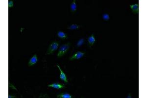 Immunofluorescent analysis of HepG2 cells using ABIN7164800 at dilution of 1:100 and Alexa Fluor 488-congugated AffiniPure Goat Anti-Rabbit IgG(H+L) (TMEM159 Antikörper  (AA 1-54))