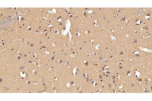 Immunohistochemistry (IHC) image for anti-Procollagen C-Endopeptidase Enhancer 2 (PCOLCE2) (AA 297-415) antibody (ABIN7438220)