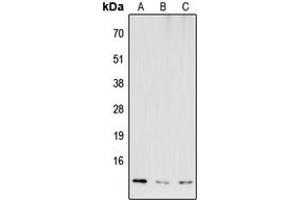 Western blot analysis of COX6B2 expression in HEK293T (A), NS-1 (B), H9C2 (C) whole cell lysates. (COX6B2 Antikörper  (Center))