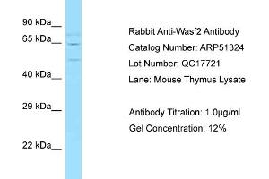 Western Blotting (WB) image for anti-WAS Protein Family, Member 2 (WASF2) (Middle Region) antibody (ABIN971997) (WASF2 Antikörper  (Middle Region))