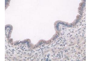 IHC-P analysis of Mouse Uterus Tissue, with DAB staining. (ADAMTS7 Antikörper  (AA 226-437))