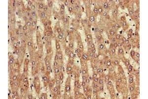 Immunohistochemistry of paraffin-embedded human liver tissue using ABIN7161610 at dilution of 1:100