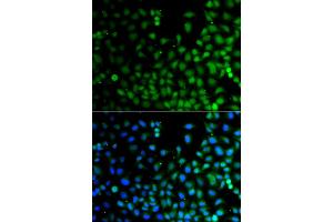 Immunofluorescence analysis of A549 cells using LHX6 antibody (ABIN6290564). (LHX6 Antikörper)