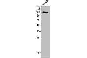 Western Blot analysis of HepG2 cells using PI 3-Kinase p110δ Polyclonal Antibody