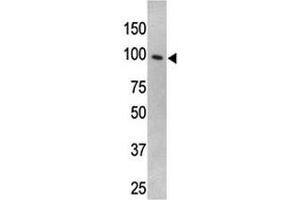 TLR5 antibody used in western blot to detect TLR5 in HL-60 cell lysate (TLR5 Antikörper  (AA 71-102))