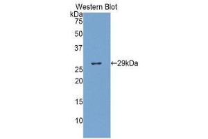 Western Blotting (WB) image for anti-Glucuronidase, beta (GUSB) (AA 440-648) antibody (ABIN1859102) (Glucuronidase beta Antikörper  (AA 440-648))
