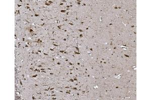 IHC analysis of CISD2 using anti-CISD2 antibody (ABIN7602010).