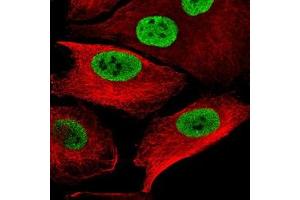 Immunofluorescence staining of WM-115 cell with antibody shows specific staining in the nucleoplasm in green. (SOX10 Antikörper)