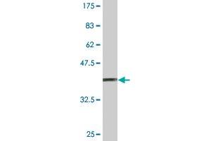 Western Blot detection against Immunogen (37. (SUPT5H Antikörper  (AA 981-1087))