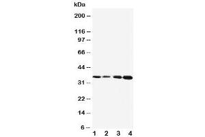 Western blot testing of Protein C antibody and Lane 1:  Jurkat (PROC Antikörper  (AA 446-461))