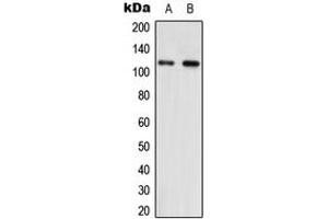 Western blot analysis of NNT expression in HEK293T (A), NIH3T3 (B) whole cell lysates. (NNT Antikörper  (Center))
