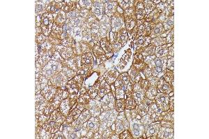 Immunohistochemistry of paraffin-embedded mouse liver using HDLBP antibody (ABIN6128051, ABIN6141701, ABIN6141702 and ABIN6221672) at dilution of 1:100 (40x lens). (HDLBP Antikörper  (AA 1035-1268))