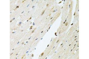 Immunohistochemistry (Paraffin-embedded Sections) (IHC (p)) image for anti-Polynucleotide Kinase 3'-Phosphatase (PNKP) antibody (ABIN7262583)