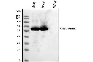 Western blot analysis of Cytokeratin 5 using anti-Cytokeratin 5 antibody (ABIN4886654).