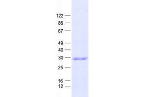 Western Blotting (WB) image for Cyclin B1 Interacting Protein 1 (CCNB1IP1) protein (His tag) (ABIN2713324)