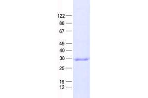 Validation with Western Blot (CCNB1IP1 Protein (His tag))