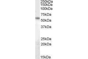 Western Blotting (WB) image for CUGBP, Elav-Like Family Member 5 (CELF5) peptide (ABIN369042) (CUGBP, Elav-Like Family Member 5 (CELF5) Peptid)