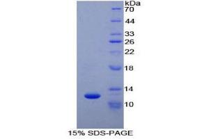SDS-PAGE (SDS) image for Cytochrome C, Somatic (CYCS) (AA 5-100) protein (His tag) (ABIN1525403)