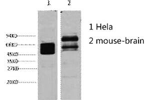 Western blot analysis of 1) Hela, 2) mouse brain, diluted at 1:4000.