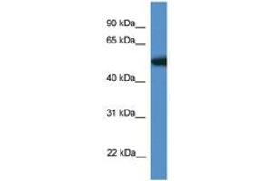 Image no. 1 for anti-Tigger Transposable Element Derived 4 (TIGD4) (AA 110-159) antibody (ABIN6746364) (TIGD4 Antikörper  (AA 110-159))