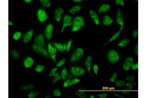 Image no. 3 for anti-Nuclear Receptor Coactivator 4 (NCOA4) (AA 505-615) antibody (ABIN599026) (NCOA4 Antikörper  (AA 505-615))