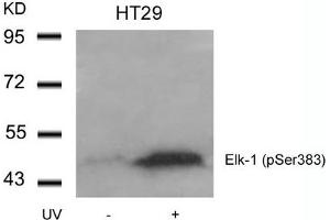 Western blot analysis of extracts from HT29 cells untreated or treated with UV using Elk-1(Phospho-Ser383) Antibody. (ELK1 Antikörper  (pSer383))