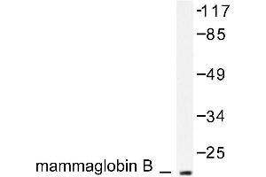 Image no. 1 for anti-Secretoglobin, Family 2A, Member 1 (SCGB2A1) antibody (ABIN265511) (SCGB2A1 Antikörper)