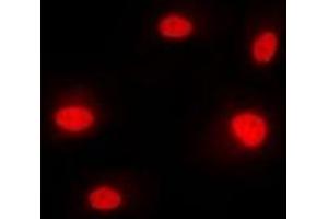 Immunofluorescent analysis of hnRNP M staining in MCF7 cells.