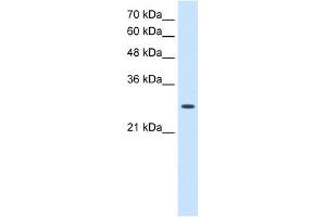 WB Suggested Anti-AK2 Antibody Titration:  2.