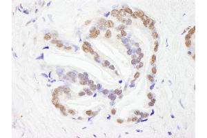 Immunohistochemistry (IHC) image for anti-RNA Binding Motif Protein 26 (RBM26) (AA 200-250) antibody (ABIN7448763) (RBM26 Antikörper  (AA 200-250))