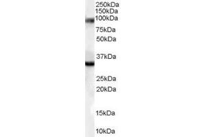 ABIN185471 (0. (LIM Domain Binding 3 Protein Antikörper  (Internal Region))