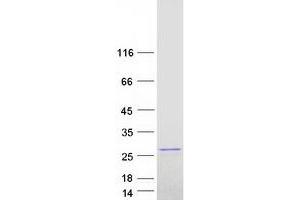 Validation with Western Blot (RAP1B Protein (Transcript Variant 2) (Myc-DYKDDDDK Tag))