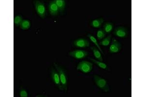 Immunofluorescent analysis of A549 cells using ABIN7176355 at dilution of 1:100 and Alexa Fluor 488-congugated AffiniPure Goat Anti-Rabbit IgG(H+L)