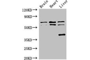 Western Blot Positive WB detected in: Mouse brain tissue, Rat heart tissue, Rat liver tissue All lanes: TRAF3IP3 antibody at 2. (TRAF3IP3 Antikörper  (AA 74-185))