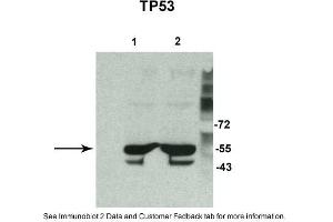 Sample Type: 1. (p53 Antikörper  (N-Term))