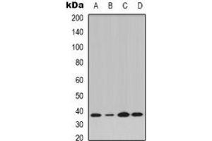 Western blot analysis of IKB alpha (pY42) expression in K562 (A), Jurkat IL1b-treated (B), Raw264. (NFKBIA Antikörper  (N-Term, pTyr42))