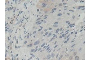 Immunohistochemistry (IHC) image for anti-Flavin Reductase (BLVRB) (AA 2-206) antibody (ABIN7441571)