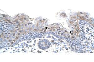 Immunohistochemistry (IHC) image for anti-Serine/threonine Kinase Receptor Associated Protein (STRAP) (N-Term) antibody (ABIN2783200)
