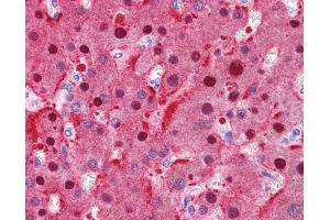 FAH antibody was used for immunohistochemistry at a concentration of 4-8 ug/ml. (FAH Antikörper)