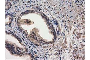 Image no. 14 for anti-Destrin (Actin Depolymerizing Factor) (DSTN) antibody (ABIN1497910) (Destrin Antikörper)