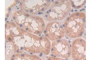 DAB staining on IHC-P; Samples: Human Kidney Tissue (LTA Antikörper  (AA 36-205))