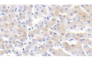 Detection of MCP2 in Bovine Liver Tissue using Polyclonal Antibody to Monocyte Chemotactic Protein 2 (MCP2) (CCL8 Antikörper  (AA 1-99))