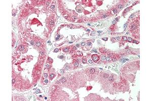 Anti-KIF6 antibody IHC staining of human kidney. (KIF6 Antikörper  (AA 177-190))