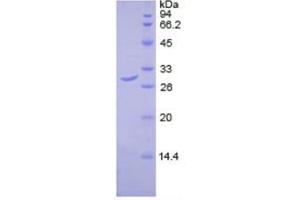 SDS-PAGE analysis of Human DLAT Protein.
