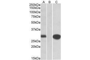 HEK293 lysate (10ug protein in RIPA buffer) overexpressing Human MID1IP1 with C-terminal MYC tag probed with AP22415PU-N (1 µg/ml) in Lane A and probed with anti-MYC Tag (1/1000) in lane C. (m1ip1 Antikörper  (Internal Region))