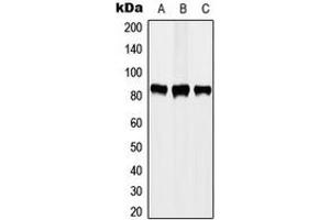 Western blot analysis of STAT3 (pY705) expression in A431 EGF-treated (A), MCF7 (B), HeLa (C) whole cell lysates. (STAT3 Antikörper  (C-Term, pTyr705))