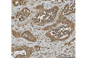 IHC analysis of Annexin A10/ANXA10 using anti-Annexin A10/ANXA10 antibody (ABIN7601853). (Annexin a10 Antikörper  (AA 49-324))